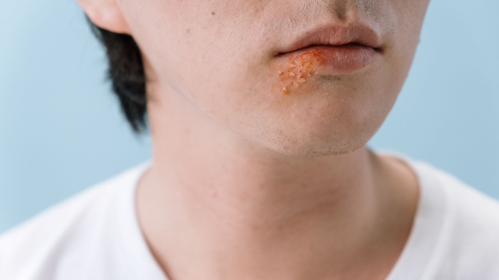 modafinil dry mouth